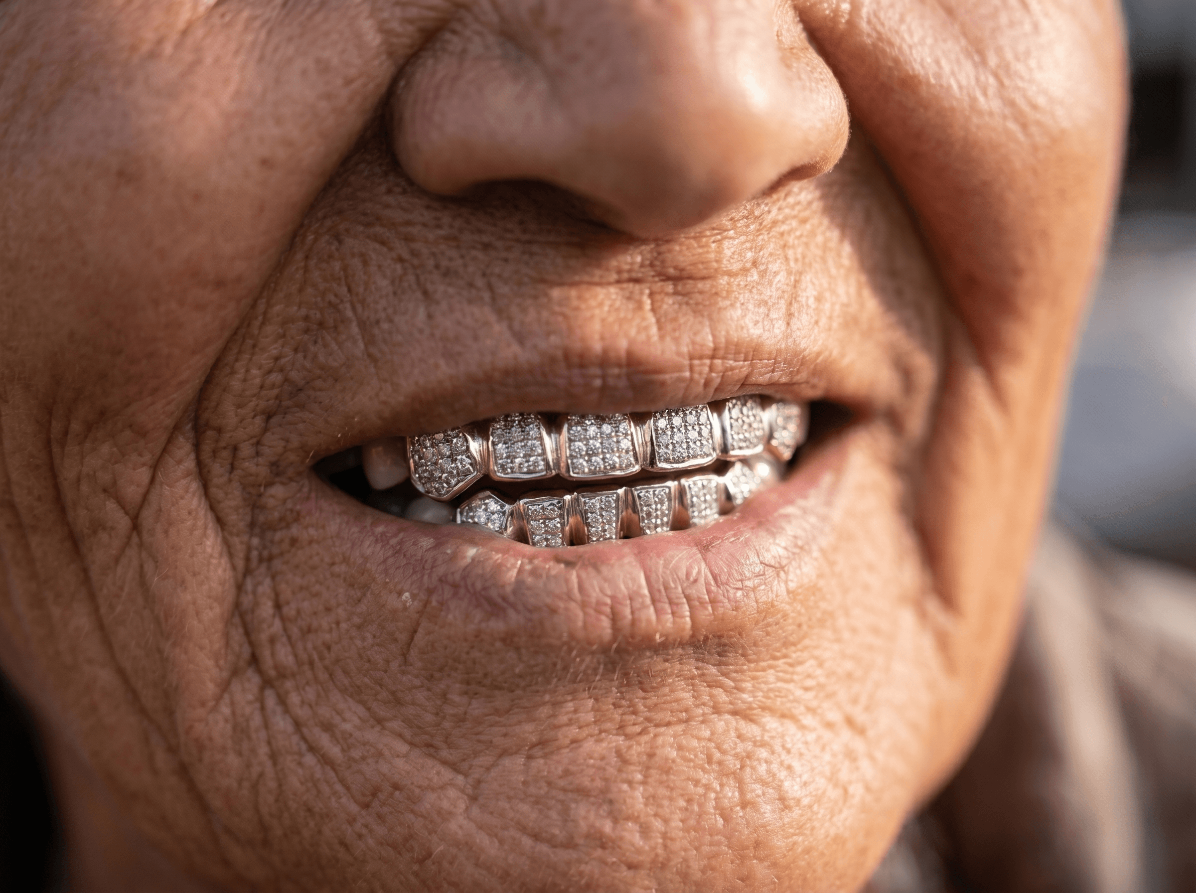 Diamond Smile Close-Up